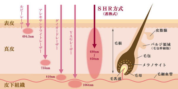 laser-wavelength ソプラノ.jpg